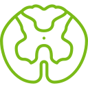 Lumbar Spondylosis treatment